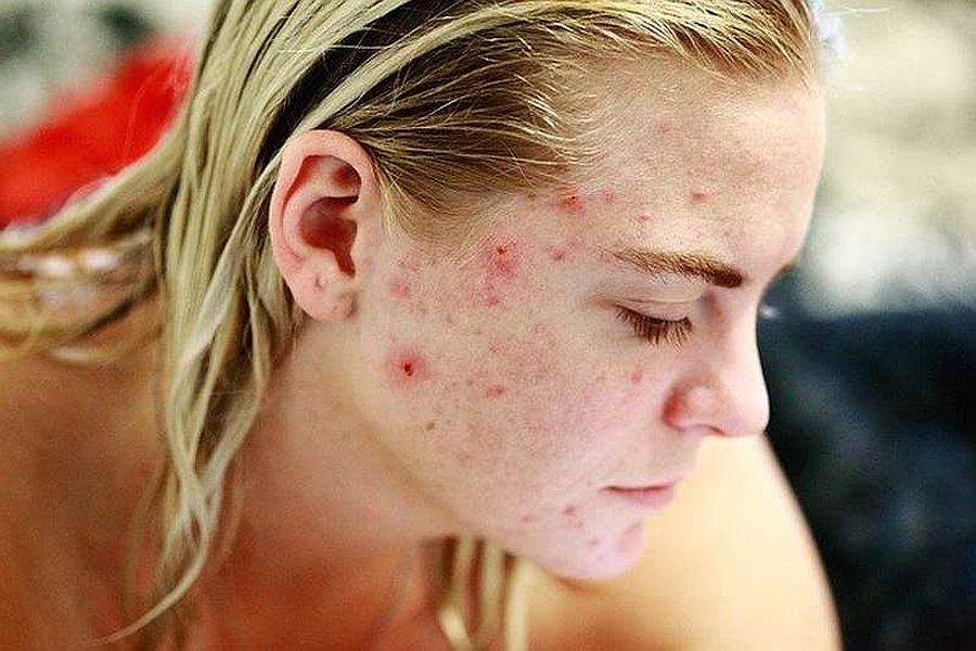 Dermatolog